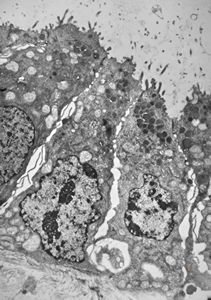 normal mucosa - stomach